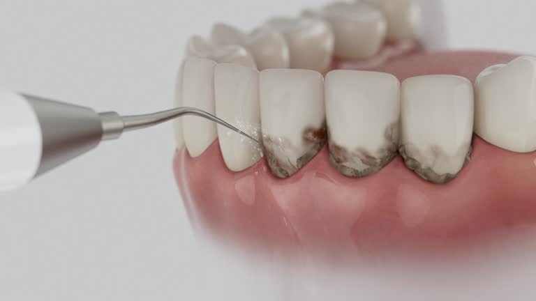 Reliable Dental contractor in Oxford, IN by Dentist Open Now